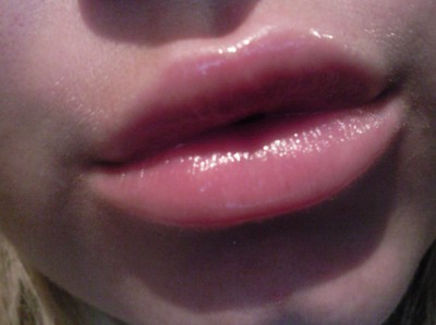 linda lips
